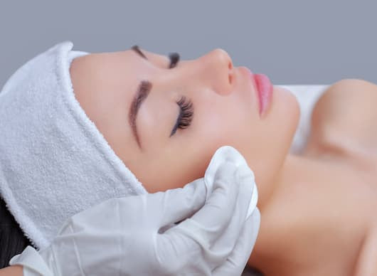 Chemical Peel